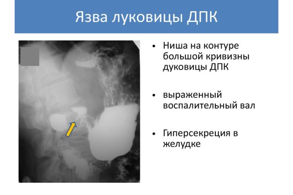 Кракен рабочая ссылка 2024